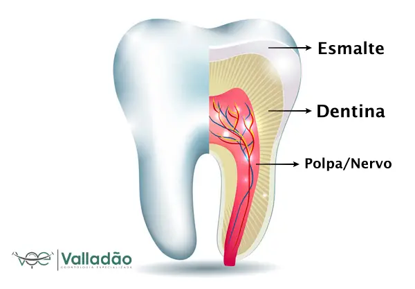 endodontia esmalte polpa nervo dentina tratamento de canal em vespasiano